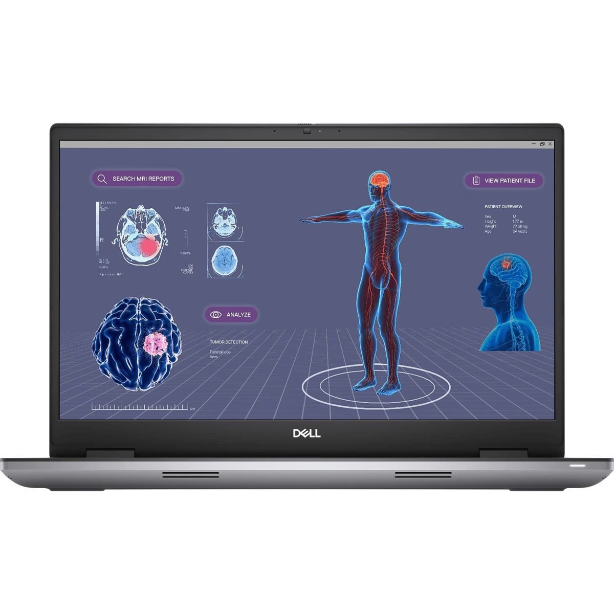 Dell Precision 7780 17.3" Laptop, Intel Core i9-13950HX, 64GB Memory, 1TB SSD, Windows 11 Pro (3GK6N) - Image 1